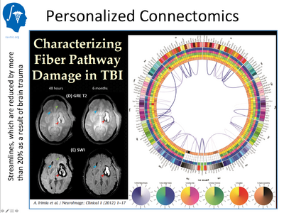 Traumatic Brain Injury (TBI): a DBP for Na-mic. The goal of the project is to develop quantitative measures for the prediction of outcome in patients with moderate to severe brain trauma. Clinical: UCLA, algorithm research: UTAH, UNC, Kitware, engineering: UCLA, Kitware, GE. Software platform for delivery to the community: 3D Slicer (this is going to happen during next year)