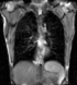 RegLib 46: 2D Cine MRI of breathing cycle