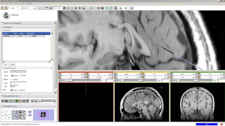 ITUM MRI.jpg