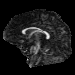 Sagittal slice of FA image