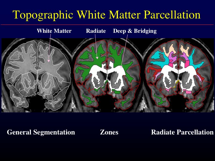 White matter parcellation: Overview