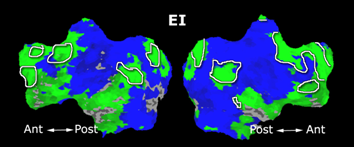 Mit fmri clustering parcellation2 shb7.png