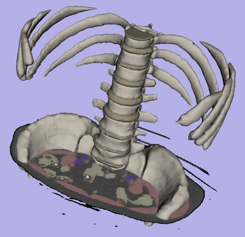 Individual vertebrae have been manually segmented in the abdominal atlas