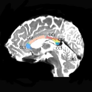 Clustering corpus2.jpg