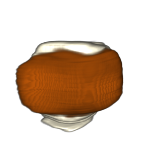 3d rendering of patella with cartilage