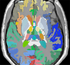 Atlas 1 with thalamic nuclei