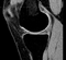 RegLib C21: knee MRI