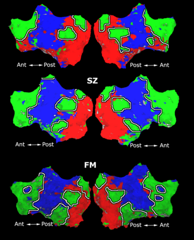 Mit fmri clustering parcellation3 shb1 3.png