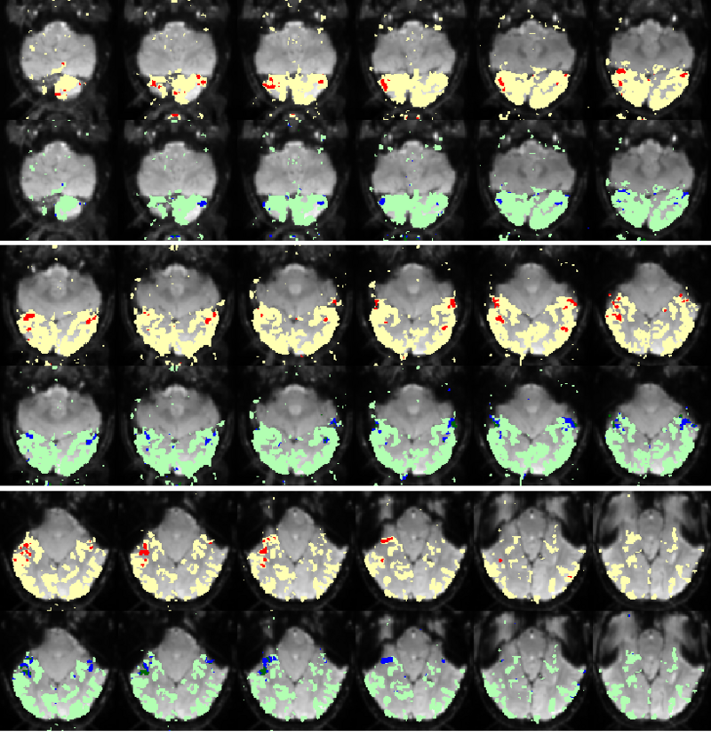 Mit fmri clustering mapffacompare.PNG