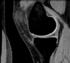 RegLib 05: Knee MRI subject 2
