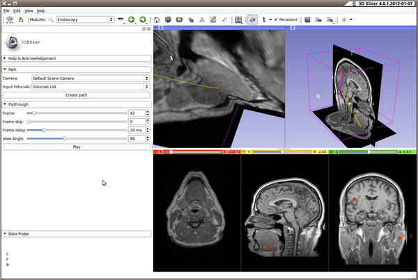 AHM2012-Slicer-Python - NAMIC Wiki