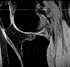 RegLib 21:inter-subject knee MRI