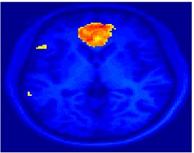 Mit fmri clustering SC 5Double.jpeg