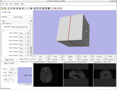 Here the Diffusion weighted images are loaded in Slicer 3