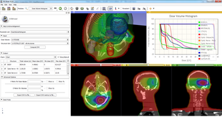 SlicerRt0.3 Screenshot DVH HeadNeck.png