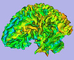 Cortical thickness on WM surface