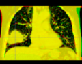 Thumbnail for version as of 21:31, 29 January 2009