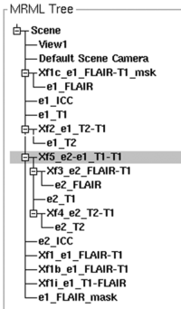the MRML node tree shows the hierarchy of multiple transfoms