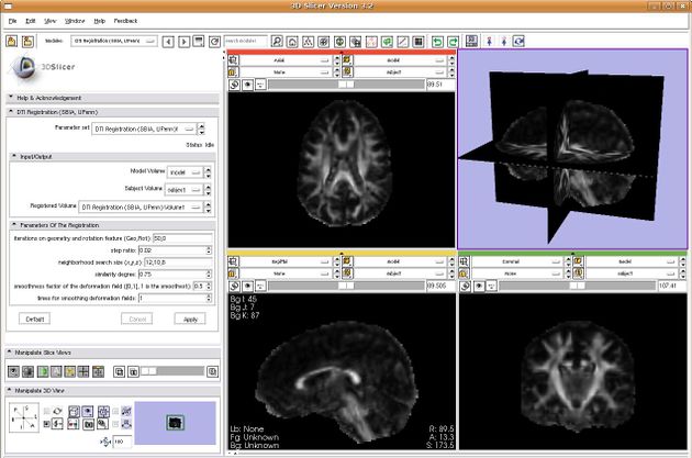 NA-MIC/Projects/Collaboration/SBIA UPenn - NAMIC Wiki