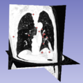 Slicer lung features.png